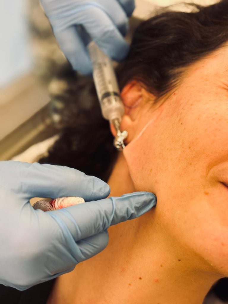 bioestimulador-de-colageno-em-brasilia