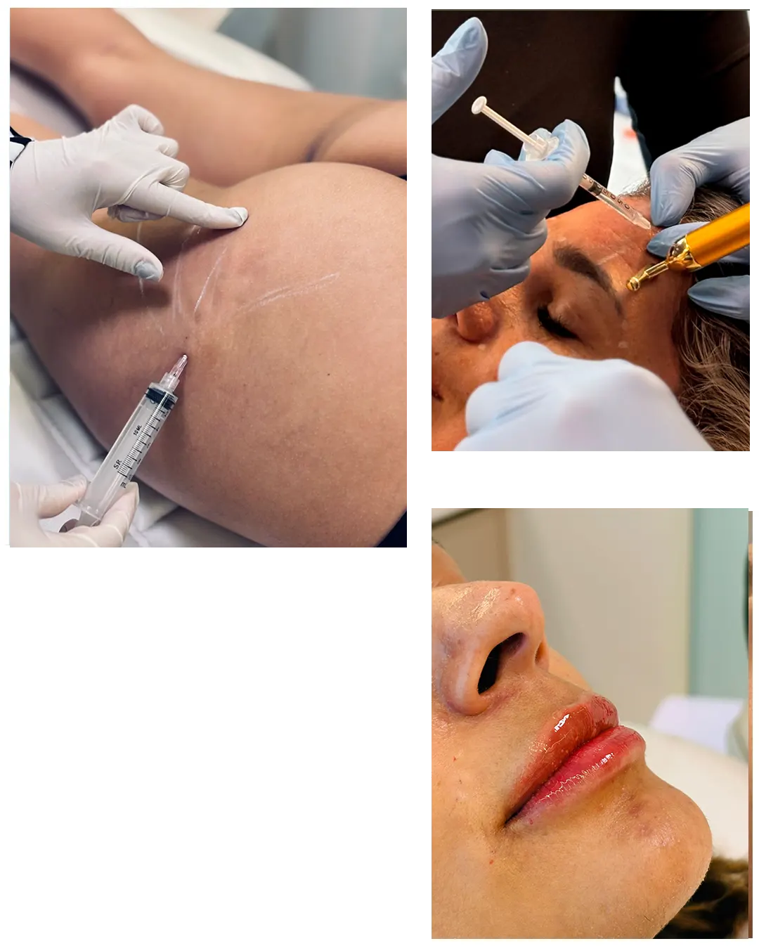 img-procedimentos-gustavo-laurindo-clinic- copy